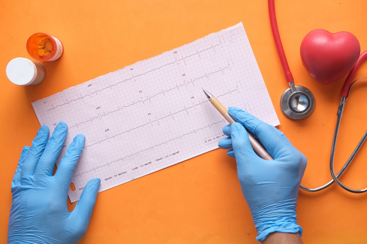 14-pros-and-cons-of-being-an-ekg-technician